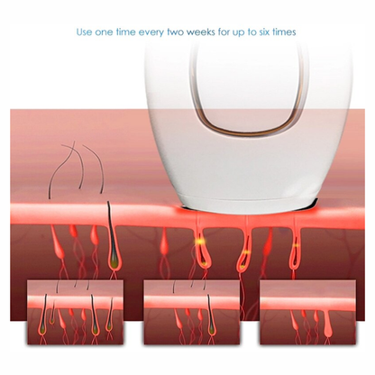 Depiladora Laser Permanente IPL Recargab